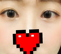 承认现代美学整形外科是眼部高手 bb