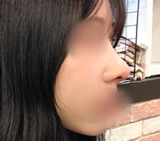脸变得更有立体感了哈哈