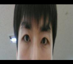 虽然有点不好意思，但这是男性双眼皮手术的真实评价..