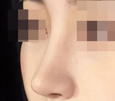 I recommend 现代美学整形外科 to anyone who wants pretty nose surgery!!!!!