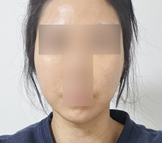 脸部线条清爽了 -