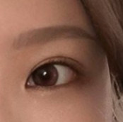 眼睛修复手术后觉得人生充满意义 ㅠ