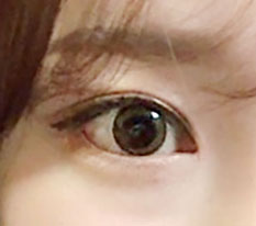 想炫耀一下术后2个月的眼睛，所以来写评价！