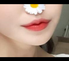 做了嘴角整形♡