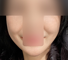 线雕我很满意