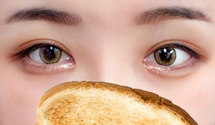 眼部修复、双眼皮修复、内眼角修复、外眼角下至
