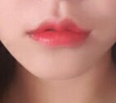 Lip surgery at 现代美学整形外科 is seriously highly recommended;