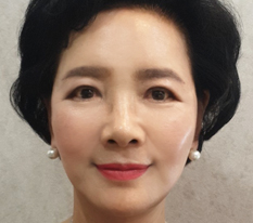 为了辛苦了一辈子的妈妈安排了面部提升手术，她特别开心