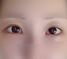 原来这就是做双重开眼角的原因啊哈哈