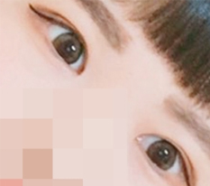 眼部评价!