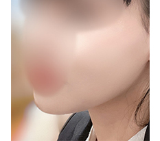 减脂针效果很好