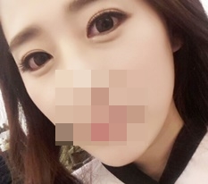 Highly recommend 现代美学整形外科 eye-shape correction!~♥