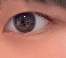 I used to have clam-like eyes