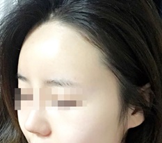 像不是我的又像是我的额头 : )