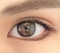 一定要做开眼角手术哈哈