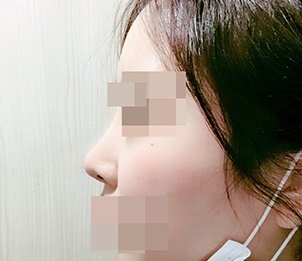 修复手术成功了 '< '♥