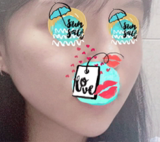 快点消肿吧~~~~~