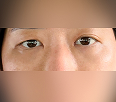 效果挺不错