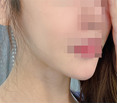 脸型变得很顺滑哈哈