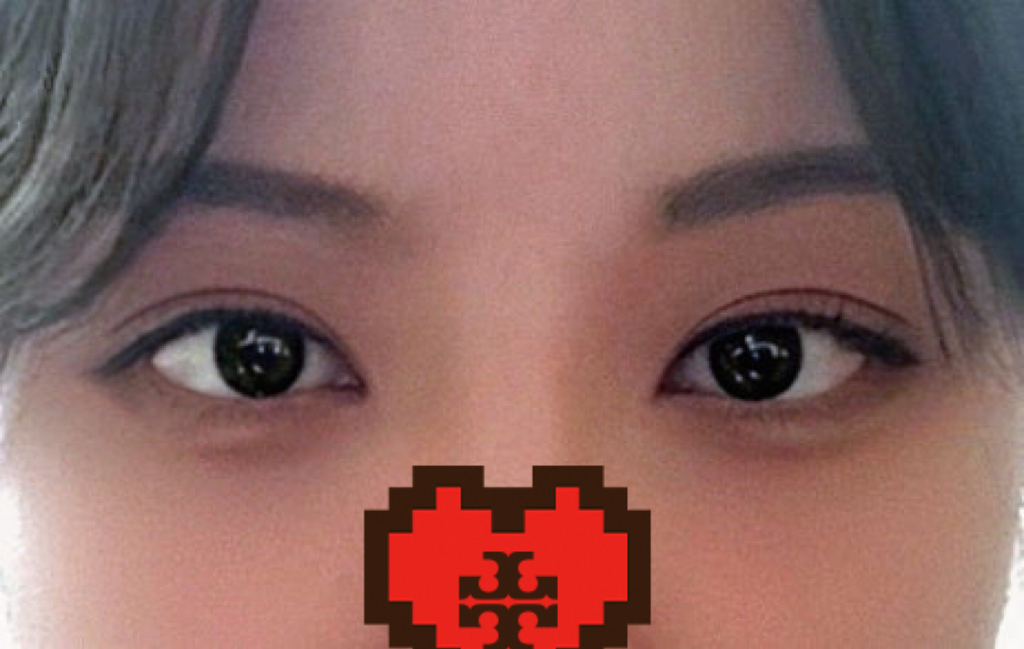 做双重开眼角和眼修复摆脱了侨胞感