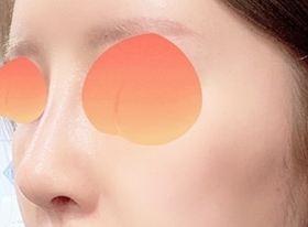 现代美学整形外科 is great for noses hehe