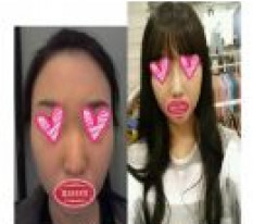 做了鼻子手术，变成了鼻梁高挺的女人~