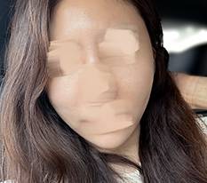 自然的V脸线条