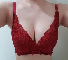 Posting my Mentor teardrop breast surgery review^^