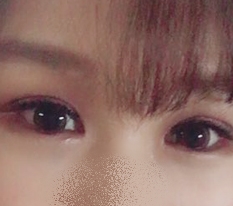双眼皮手术让我的眼睛焕然一新 ♥