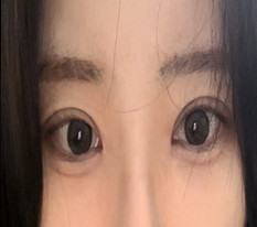 眼睛变得超级大了！