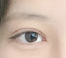 做完双眼皮后像过上新人生ㅠㅠ