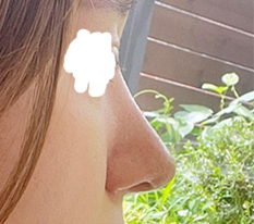 终于意识到选择医院和医生有多重要！