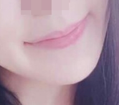 嘴角变得性感