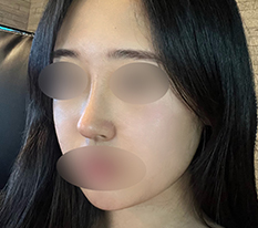收获自然华丽感鼻子