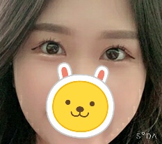 When it comes to eyes, 现代美学整形外科 really seems right haha