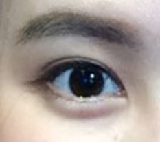 确实有资格被叫作双眼皮和开眼角名店哈哈