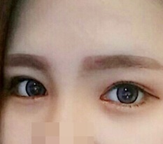 只是做了眼睛，却有种重生的感觉ㅠㅠ
