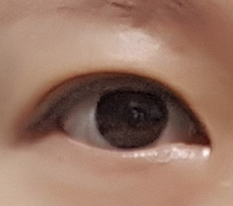 提肌双眼皮4个月啦~^^