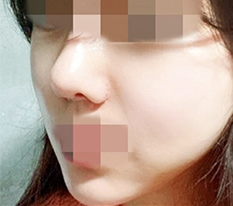 我做了轮廓手术，来发评价了 哈哈
