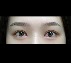 眼睛终于有存在感了哈哈