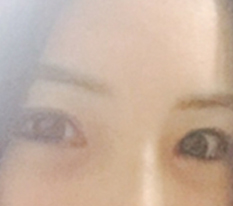 我做了眼部修复 ㅠㅠㅠㅠ