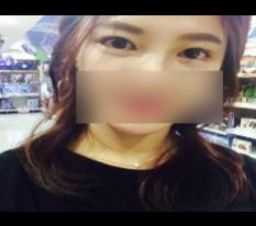 只做了开内眼角、外眼角和下至 哈哈