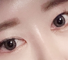 做了开眼角修复 ~.~ 认可现代美学整形外科 ♡♡