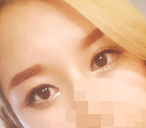 眼部整形强烈推荐！！！！