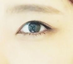 摆脱困倦眼