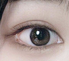 双开眼角已经两个月了，效果不错吧??
