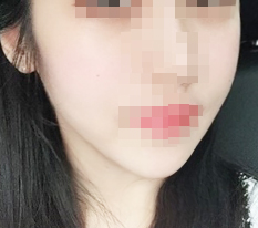 下巴尖缩小!! review~