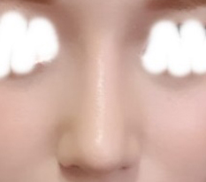 鼻子就选现代美学整形外科!!