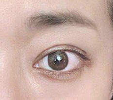 眼睛做了怎么样？你们觉得看起来自然吗？？
