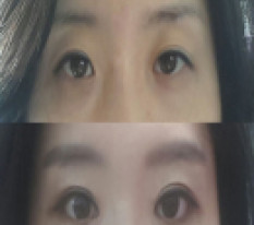 摆脱困倦眼的评价